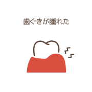 歯ぐきが腫れたイメージイラスト