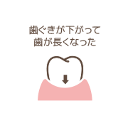 歯ぐきが下がって歯が長くなったイメージイラスト