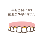 年をとるにつれ歯並びが悪くなったイメージイラスト