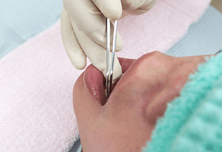 動揺度の測定の写真