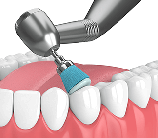 歯面を研磨するイメージイラスト