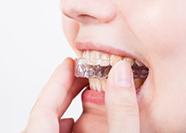 マウスピース型矯正装置