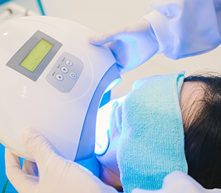 オフィスホワイトニングの写真