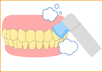 STEP.2クリーニングのイラスト