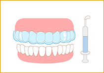 STEP.4ホワイトニング中のイラスト