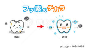 セラミック治療とは